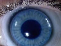 Contact lens with artificial pupil